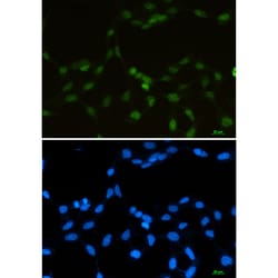 Invitrogen RBMX Recombinant Rabbit Monoclonal Antibody (K01_1S36) 50 &mu;L | Buy Online | Invitrogen&trade; | Fisher Scientific
