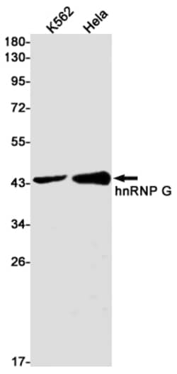 Invitrogen RBMX Recombinant Rabbit Monoclonal Antibody (K01_1S36) 50 &mu;L | Buy Online | Invitrogen&trade; | Fisher Scientific