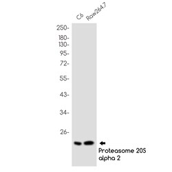 Invitrogen PSMB9 Recombinant Rabbit Monoclonal Antibody (K01_1X17) 100 &mu;L | Buy Online | Invitrogen&trade; | Fisher Scientific
