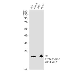 Invitrogen PSMB9 Recombinant Rabbit Monoclonal Antibody (K01_1X17) 100 &mu;L | Buy Online | Invitrogen&trade; | Fisher Scientific