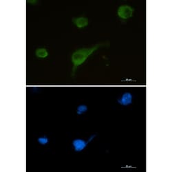 Invitrogen Syntrophin alpha-1 Recombinant Rabbit Monoclonal Antibody (K01_1Y97) 50 &mu;L | Buy Online | Invitrogen&trade; | Fisher Scientific