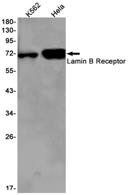 Invitrogen Lamin B Receptor Recombinant Rabbit Monoclonal Antibody (K01_1T35) 100 &mu;L | Buy Online | Invitrogen&trade; | Fisher Scientific