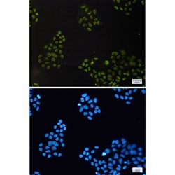Invitrogen CGBP Recombinant Rabbit Monoclonal Antibody (K01_1P50) 50 &mu;L | Buy Online | Invitrogen&trade; | Fisher Scientific