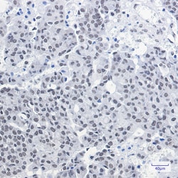 Invitrogen CGBP Recombinant Rabbit Monoclonal Antibody (K01_1P50) 50 &mu;L | Buy Online | Invitrogen&trade; | Fisher Scientific