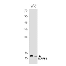 Invitrogen NDUFB2 Recombinant Rabbit Monoclonal Antibody (K01_1U53) 50 &mu;L | Buy Online | Invitrogen&trade; | Fisher Scientific