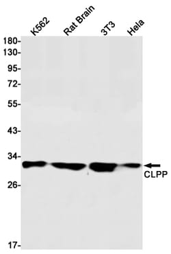 Invitrogen CLPP Recombinant Rabbit Monoclonal Antibody (K01_1P64) 100 &mu;L | Buy Online | Invitrogen&trade; | Fisher Scientific