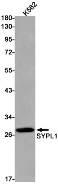 Invitrogen SYPL1 Recombinant Rabbit Monoclonal Antibody (K01_1Y98) 100 &mu;L | Buy Online | Invitrogen&trade; | Fisher Scientific