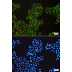 Invitrogen COX1 Recombinant Rabbit Monoclonal Antibody (K01_1P73) 50 &mu;L | Buy Online | Invitrogen&trade; | Fisher Scientific
