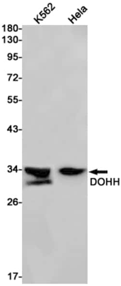Invitrogen DOHH Recombinant Rabbit Monoclonal Antibody (K01_1Q54) 50 &mu;L;