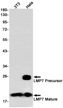 Invitrogen PSMB8 Recombinant Rabbit Monoclonal Antibody (K01_1T51) 100 &mu;L | Buy Online | Invitrogen&trade; | Fisher Scientific