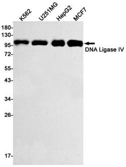 Invitrogen DNA ligase IV Recombinant Rabbit Monoclonal Antibody (K01_1Q47) 50 &mu;L | Buy Online | Invitrogen&trade; | Fisher Scientific