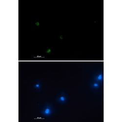 Invitrogen NUDT19 Recombinant Rabbit Monoclonal Antibody (K01_1U99) 100 &mu;L | Buy Online | Invitrogen&trade; | Fisher Scientific