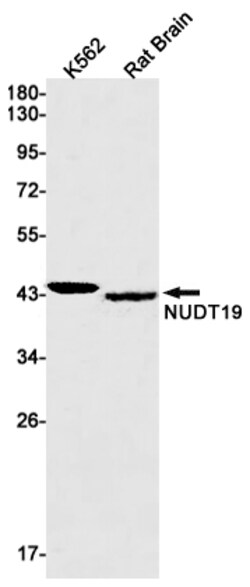 Invitrogen NUDT19 Recombinant Rabbit Monoclonal Antibody (K01_1U99) 100 &mu;L | Buy Online | Invitrogen&trade; | Fisher Scientific