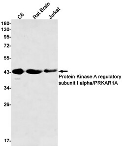Invitrogen PRKAR1A Recombinant Rabbit Monoclonal Antibody (K01_1X19) 100 &mu;L | Buy Online | Invitrogen&trade; | Fisher Scientific