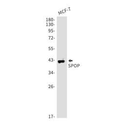 Invitrogen&trade;&nbsp;SPOP Recombinant Rabbit Monoclonal Antibody (K01_1Y71)
