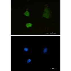 Invitrogen PSMA2 Recombinant Rabbit Monoclonal Antibody (K01_1X16) 100 &mu;L | Buy Online | Invitrogen&trade; | Fisher Scientific