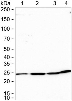 Invitrogen PSMA2 Recombinant Rabbit Monoclonal Antibody (K01_1X16) 100 &mu;L | Buy Online | Invitrogen&trade; | Fisher Scientific