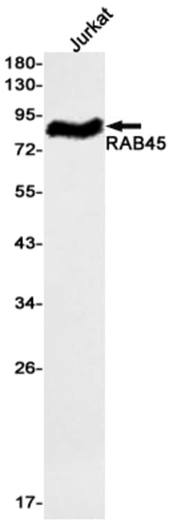 Invitrogen RASEF Recombinant Rabbit Monoclonal Antibody (K01_1X43) 50 &mu;L;