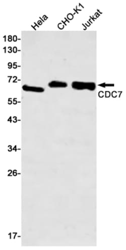 Invitrogen CDC7 Recombinant Rabbit Monoclonal Antibody (K01_1P34) 100 &mu;L | Buy Online | Invitrogen&trade; | Fisher Scientific