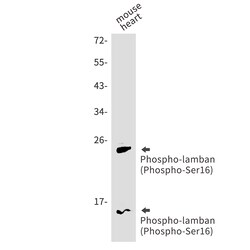 Invitrogen Phospho-Phospholamban (Ser16) Recombinant Rabbit Monoclonal Antibody (K01_1W72) 50 &mu;L | Buy Online | Invitrogen&trade; | Fisher Scientific