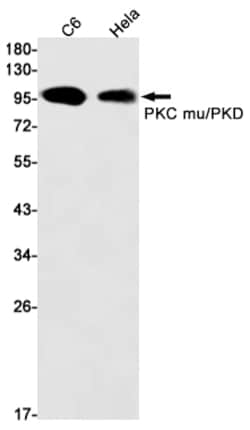 Invitrogen PKC mu Recombinant Rabbit Monoclonal Antibody (K01_1W85) 100 &mu;L | Buy Online | Invitrogen&trade; | Fisher Scientific