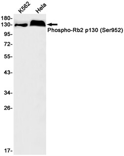 Invitrogen Phospho-p130 (Ser952) Recombinant Rabbit Monoclonal Antibody (K01_1X68) 100 &mu;L | Buy Online | Invitrogen&trade; | Fisher Scientific