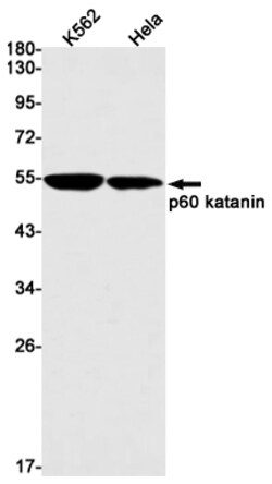 Invitrogen KATNA1 Recombinant Rabbit Monoclonal Antibody (K01_1W25) 50