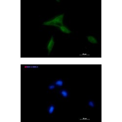 Invitrogen NDUFAF1 Recombinant Rabbit Monoclonal Antibody (K01_1U48) 50 &mu;L | Buy Online | Invitrogen&trade; | Fisher Scientific