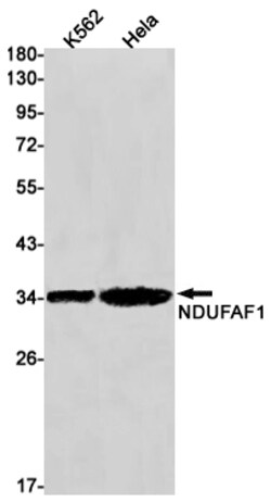 Invitrogen NDUFAF1 Recombinant Rabbit Monoclonal Antibody (K01_1U48) 50 &mu;L | Buy Online | Invitrogen&trade; | Fisher Scientific