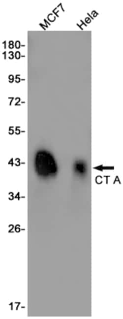 Invitrogen PCYT1A Recombinant Rabbit Monoclonal Antibody (K01_1P86) 50 &mu;L | Buy Online | Invitrogen&trade; | Fisher Scientific
