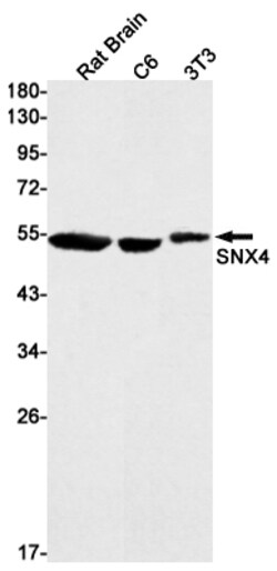Invitrogen SNX4 Recombinant Rabbit Monoclonal Antibody (K01_1Y62) 50 &mu;L | Buy Online | Invitrogen&trade; | Fisher Scientific
