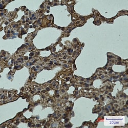 Invitrogen&trade;&nbsp;LYVE1 Recombinant Rabbit Monoclonal Antibody (K01_1T58)