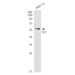 Invitrogen TdT Recombinant Rabbit Monoclonal Antibody (K01_2J18) 100 &mu;L | Buy Online | Invitrogen&trade; | Fisher Scientific