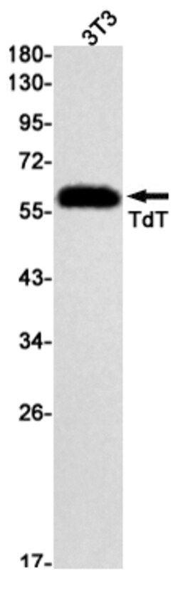 Invitrogen TdT Recombinant Rabbit Monoclonal Antibody (K01_2J18) 100 &mu;L | Buy Online | Invitrogen&trade; | Fisher Scientific