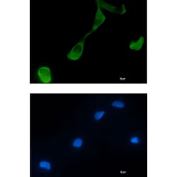 Invitrogen GFPT2 Recombinant Rabbit Monoclonal Antibody (K01_1R65) 100 &mu;L | Buy Online | Invitrogen&trade; | Fisher Scientific