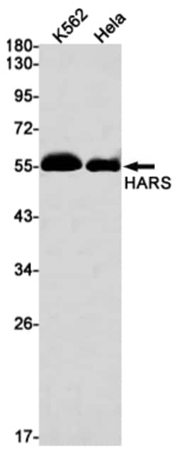 Invitrogen HARS Recombinant Rabbit Monoclonal Antibody (K01_1S03) 100 &mu;L | Buy Online | Invitrogen&trade; | Fisher Scientific