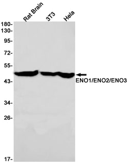 Invitrogen&trade;&nbsp;ENO1/2/3 Recombinant Rabbit Monoclonal Antibody (K01_1Q80)
