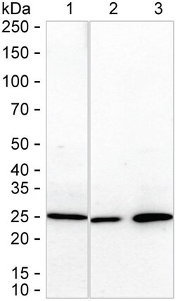 Invitrogen DCI Recombinant Rabbit Monoclonal Antibody (K01_1Q28) 100 &mu;L | Buy Online | Invitrogen&trade; | Fisher Scientific