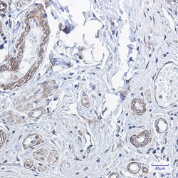 Invitrogen PP1 beta Recombinant Rabbit Monoclonal Antibody (K01_1X02) 100 &mu;L | Buy Online | Invitrogen&trade; | Fisher Scientific