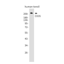 Invitrogen CD35 Recombinant Rabbit Monoclonal Antibody (K01_1P21) 100 &mu;L | Buy Online | Invitrogen&trade; | Fisher Scientific