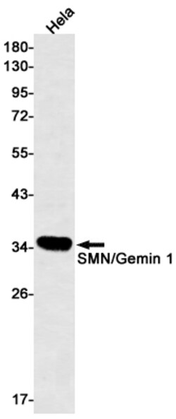 Invitrogen SMN1 Recombinant Rabbit Monoclonal Antibody (K01_1R60) 100 &mu;L | Buy Online | Invitrogen&trade; | Fisher Scientific