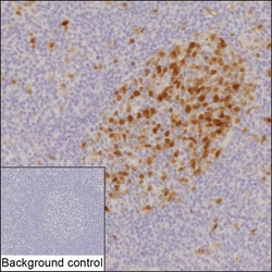 Invitrogen Securin Recombinant Rabbit Monoclonal Antibody (K01_1Y21) 100 &mu;L | Buy Online | Invitrogen&trade; | Fisher Scientific