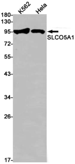 Invitrogen SLCO5A1 Recombinant Rabbit Monoclonal Antibody (K01_1Y49) 100 &mu;L | Buy Online | Invitrogen&trade; | Fisher Scientific