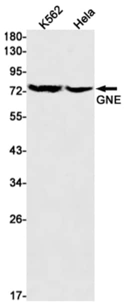 Invitrogen GNE Recombinant Rabbit Monoclonal Antibody (K01_1R67) 50 &mu;L | Buy Online | Invitrogen&trade; | Fisher Scientific