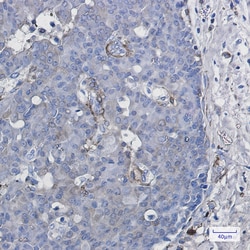 Invitrogen&trade;&nbsp;CYP1B1 Recombinant Rabbit Monoclonal Antibody (K01_1Q09)