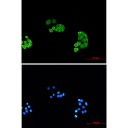 Invitrogen PSMA6 Recombinant Rabbit Monoclonal Antibody (K01_1X18) 100 &mu;L | Buy Online | Invitrogen&trade; | Fisher Scientific