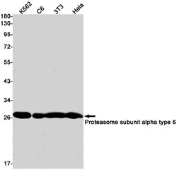 Invitrogen PSMA6 Recombinant Rabbit Monoclonal Antibody (K01_1X18) 100 &mu;L | Buy Online | Invitrogen&trade; | Fisher Scientific