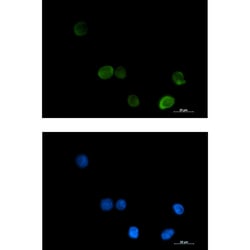 Invitrogen MTHFR Recombinant Rabbit Monoclonal Antibody (K01_1U19) 50 &mu;L | Buy Online | Invitrogen&trade; | Fisher Scientific