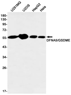 Invitrogen DFNA5 Recombinant Rabbit Monoclonal Antibody (K01_1Q36) 50 &mu;L | Buy Online | Invitrogen&trade; | Fisher Scientific