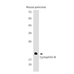 Invitrogen Cyclophilin B Recombinant Rabbit Monoclonal Antibody (K01_1Q06) 100 &mu;L | Buy Online | Invitrogen&trade; | Fisher Scientific